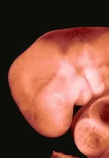 Fig 3. Menselijk embryo van ruim 4 weken oud